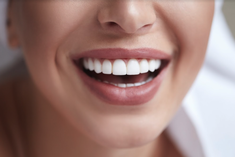 patient with bright smile | veneers goffstown nh