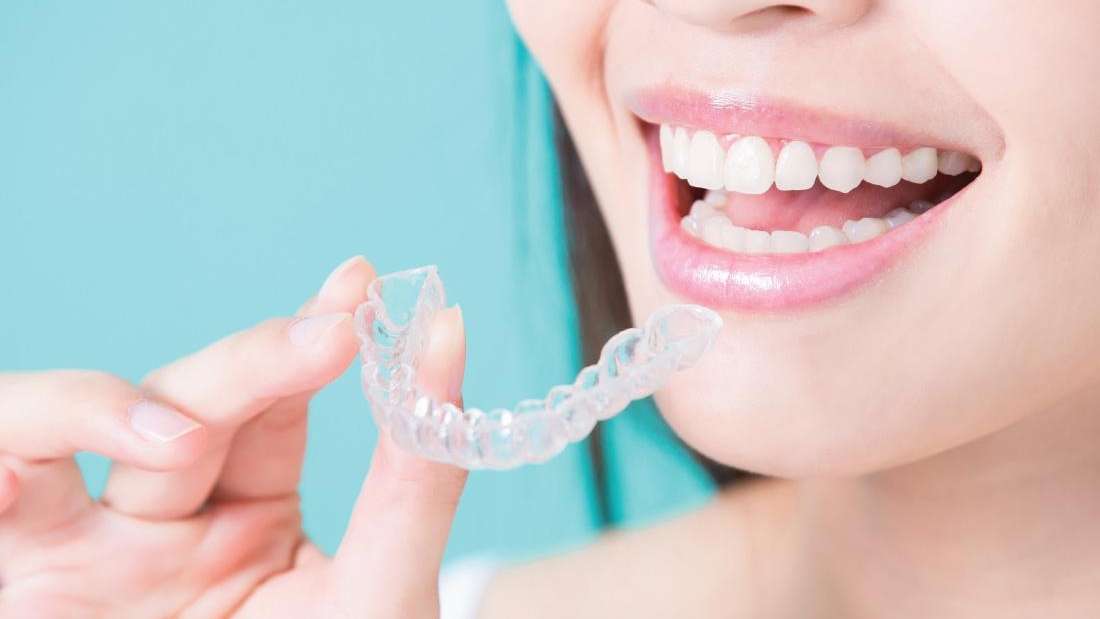 Can Invisalign Fix My Overbite? Invisalign in Goffstown NH